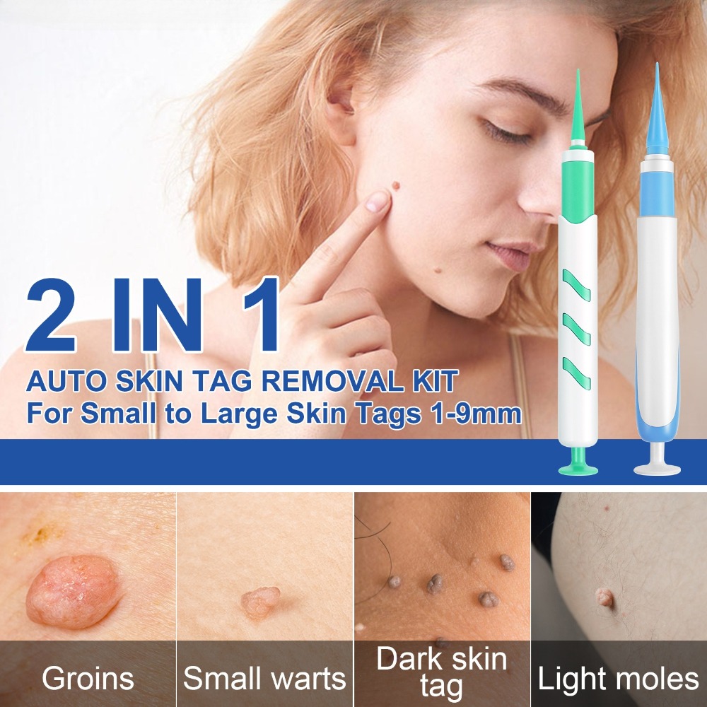 2-IN-1 Auto Skin Tag Removal T - Acne Light Therapy Pen recensie en prijs