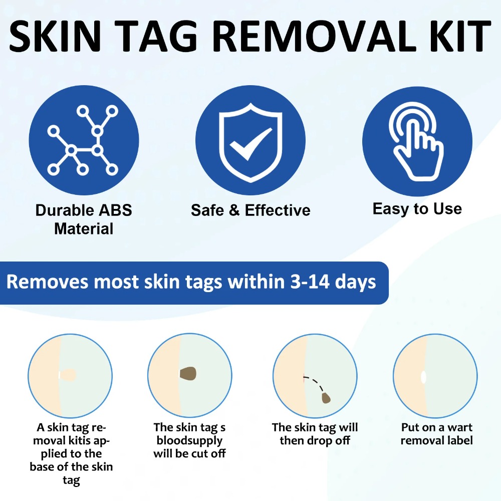 2-IN-1 Auto Skin Tag Removal T - Acne Light Therapy Pen recensie en prijs